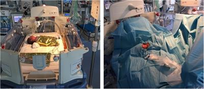 Combination of ketamine and fentanyl (KetaFent) for safe insertion of ultrasound-guided central venous catheters in infants